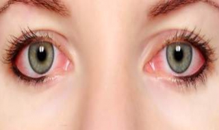眼球有血丝怎么办 ，7种方式帮到你