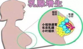 有了乳腺增生怎么办 7个小妙招带你远离