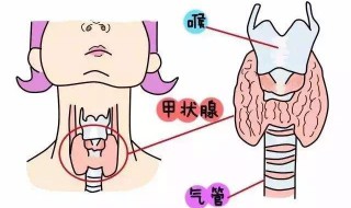 甲状腺4a危险吗 有没有癌化可能