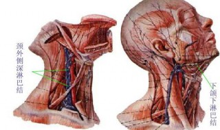 究竟下颚淋巴结肿大怎么消 4种方法消除下颚淋巴结肿大