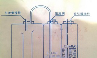 引流术没有引流管多久可以愈合 会感染吗