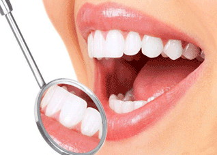 五种牙齿美白的优缺点详解