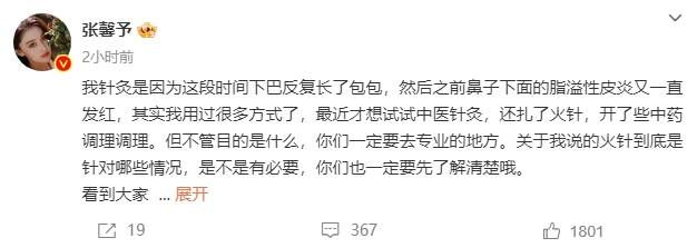 张馨予针灸是为了治疗长痘 回应在脸上做针灸原因